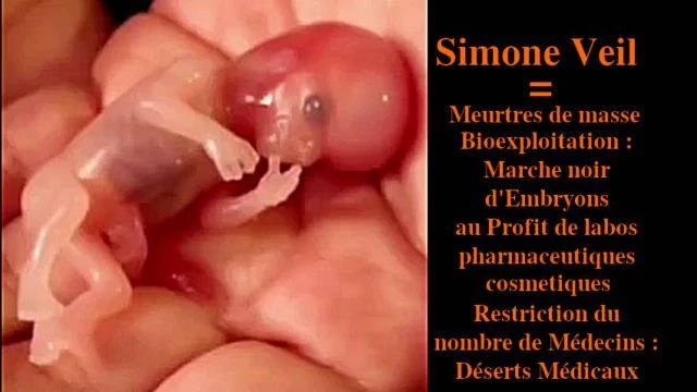 Simone Veil - IVG embryons - meurtre rentable - marche noir - organes - desert medical