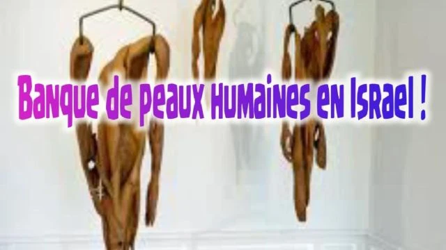 Banque de peaux humaines en Israel