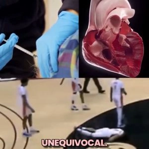 SYNDROME DE MORT SUBITE DE L’ADULTE