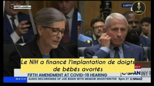 Dr Fauci a fait implanter des doigts et des cuirs chevelus de bébés avortés dans le dos de souris de laboratoire
